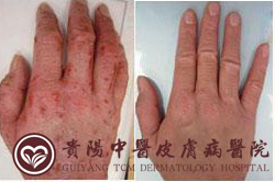 �Ϸʻ���Ƥ����ҽԺƤ����